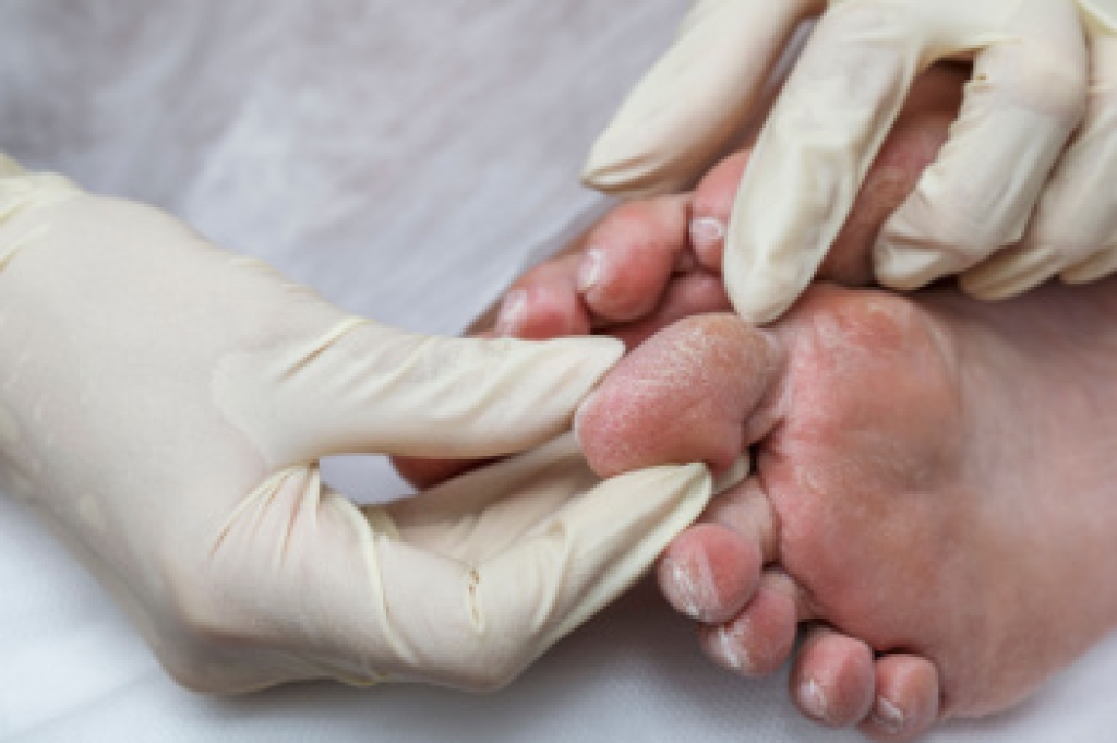 Limb Salvage and Its Importance in Foot Health