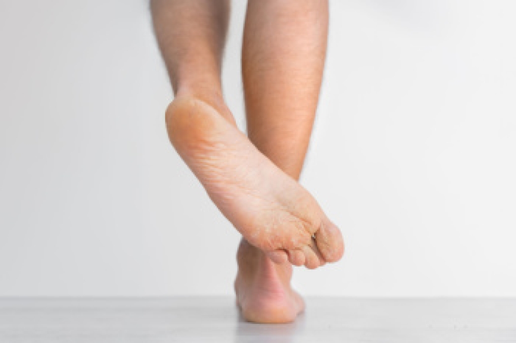 How a Podiatrist Can Treat Athlete’s Foot