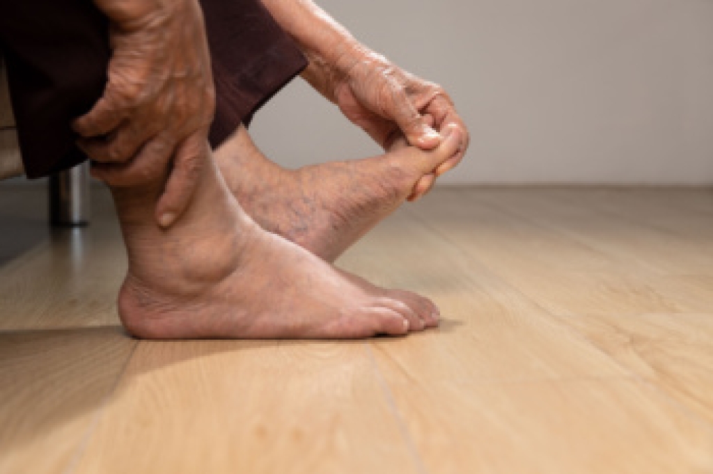 The Difference Between Gout and Pseudogout