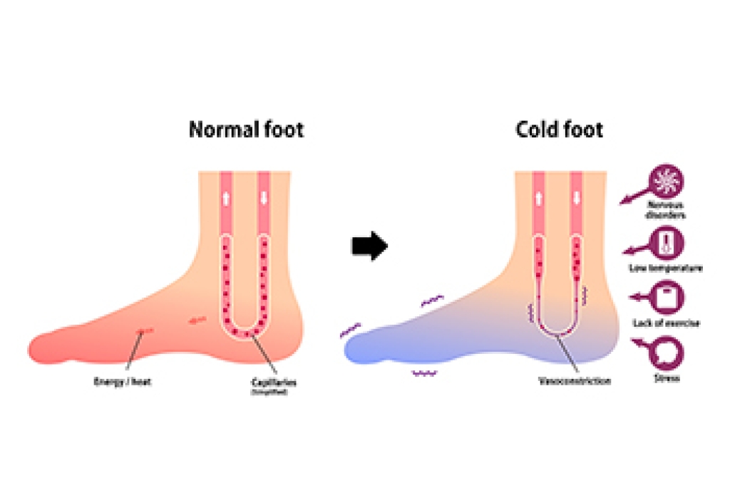 Cold Feet and Underlying Health Conditions