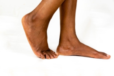Managing Flat Feet